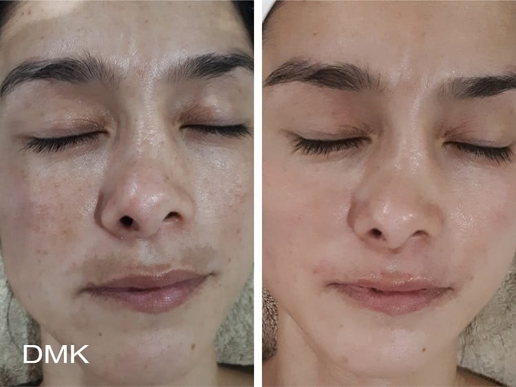 dmk pigmentation 1